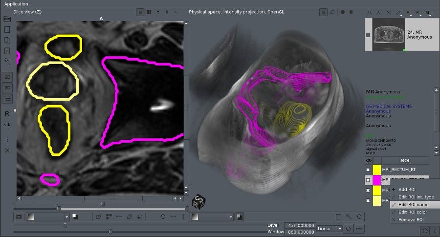 Aliza MSfree open-source DICOM viewer