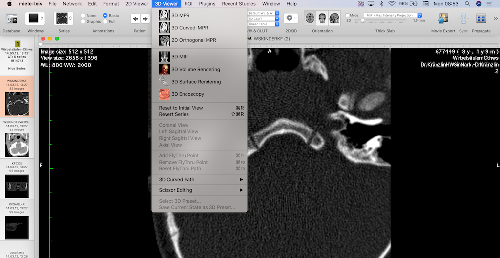 Miele-LXIVOpen source and Free DICOM Workstation & Viewer for macOS